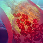 hudsonphysicians cholesterol_blog